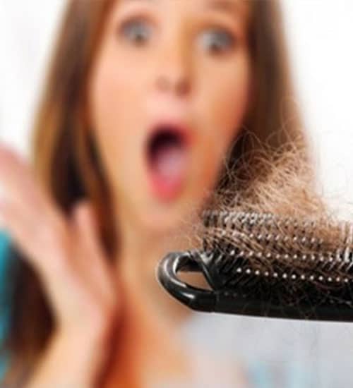 علل ریزش موی زنان