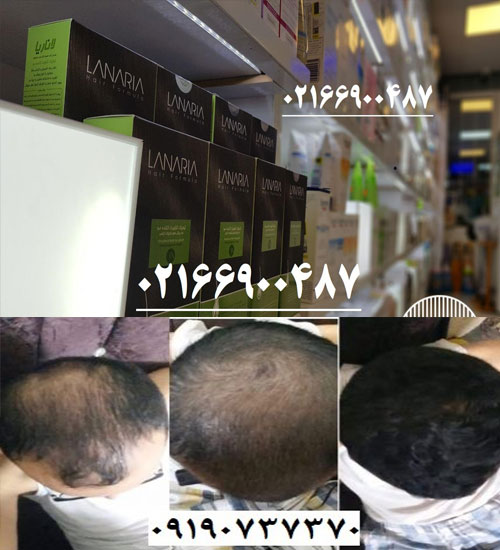 پکیجی قدرتمند برای درمان ریزش مو